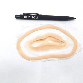 Risswunde